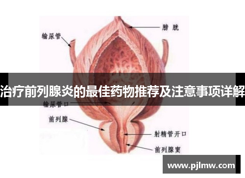 治疗前列腺炎的最佳药物推荐及注意事项详解